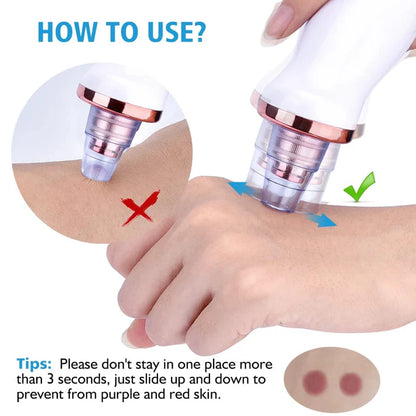 5 in 1 Blackhead remover | Derma Suction | Rechargeable